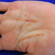 Image for article titled People Are Literally Getting Palm Line Surgery for Better Fortunes